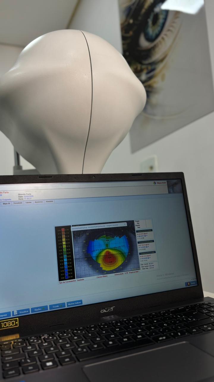 Topografia corneana no monitor